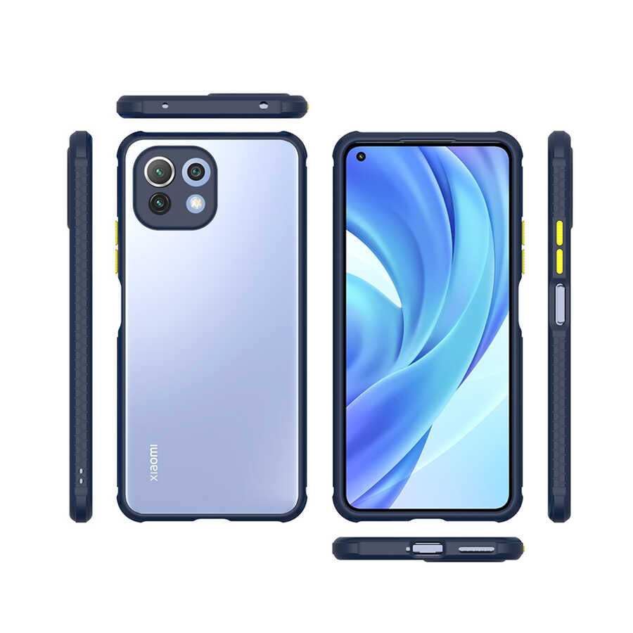 Xiaomi Mi 11 Lite Kılıf Zore Kaff Kapak Siyah