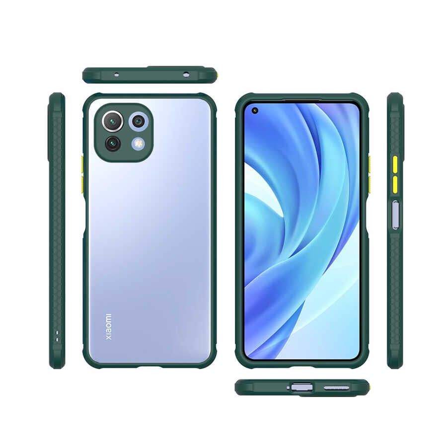 Xiaomi Mi 11 Lite Kılıf Zore Kaff Kapak Siyah