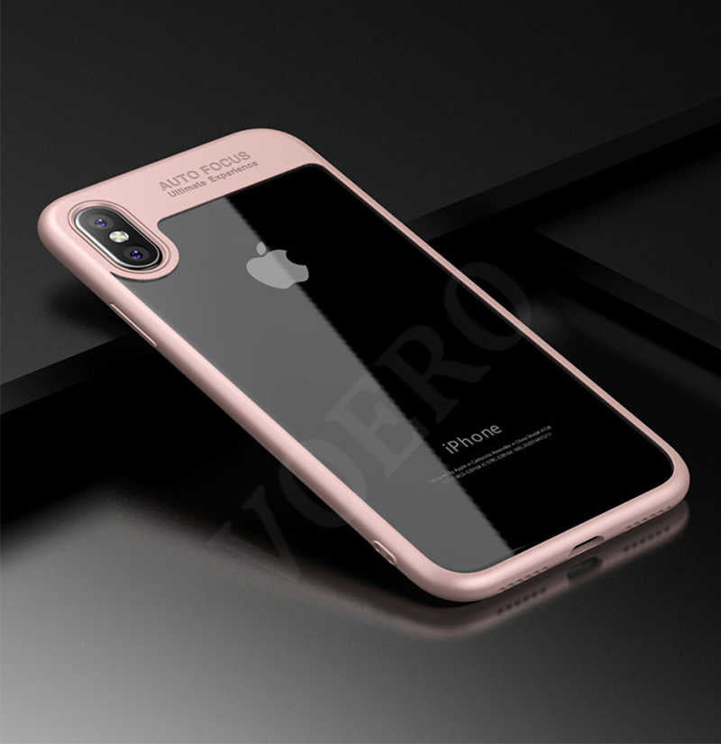 Apple iPhone X Kılıf Zore Buttom Kapak Pembe