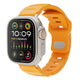 Apple Watch 38mm Zore KRD-143 Silikon Kordon Sarı