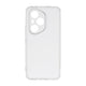 Honor 400 Pro Zore 2mm Anti Shock Silikon