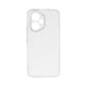 Honor 400 Zore 2mm Anti Shock Silikon Şeffaf