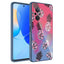 Huawei Nova 9 SE Kılıf Kamera Korumalı Desenli Sert Silikon Zore Epoksi Kapak