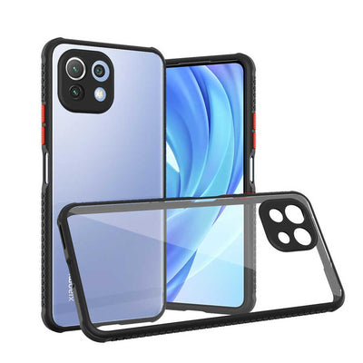 Xiaomi Mi 11 Lite Kılıf Zore Kaff Kapak Siyah