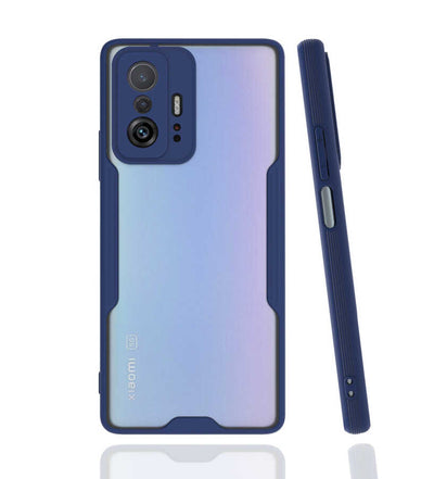 Xiaomi Mi 11T Pro 5G Kılıf Zore Parfe Kapak Lacivert
