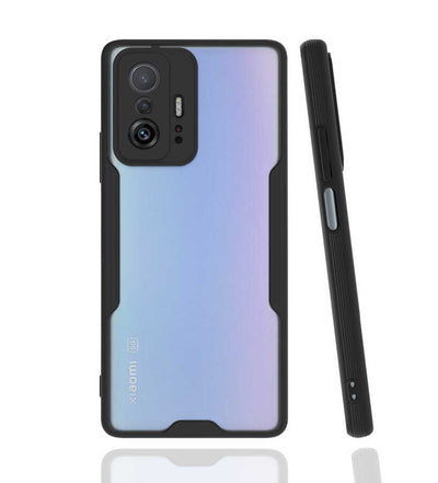 Xiaomi Mi 11T Pro 5G Kılıf Zore Parfe Kapak Siyah