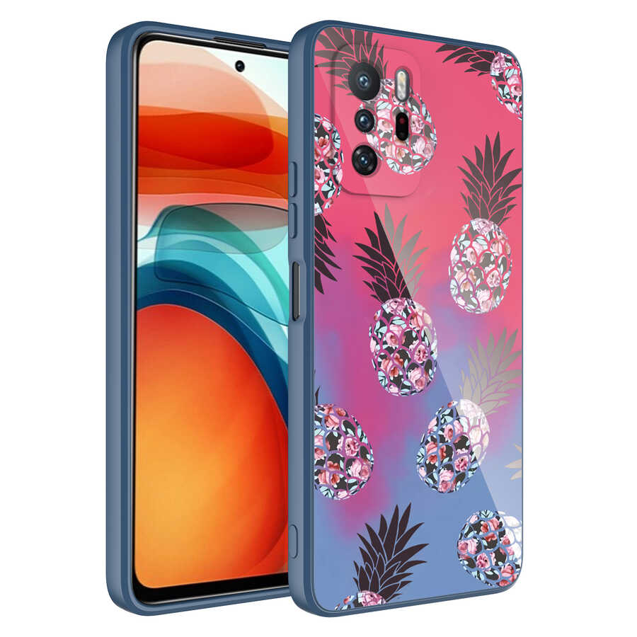 Xiaomi Redmi Note 10 Pro Kılıf Kamera Korumalı Desenli Sert Silikon Zore Epoksi Kapak NO3